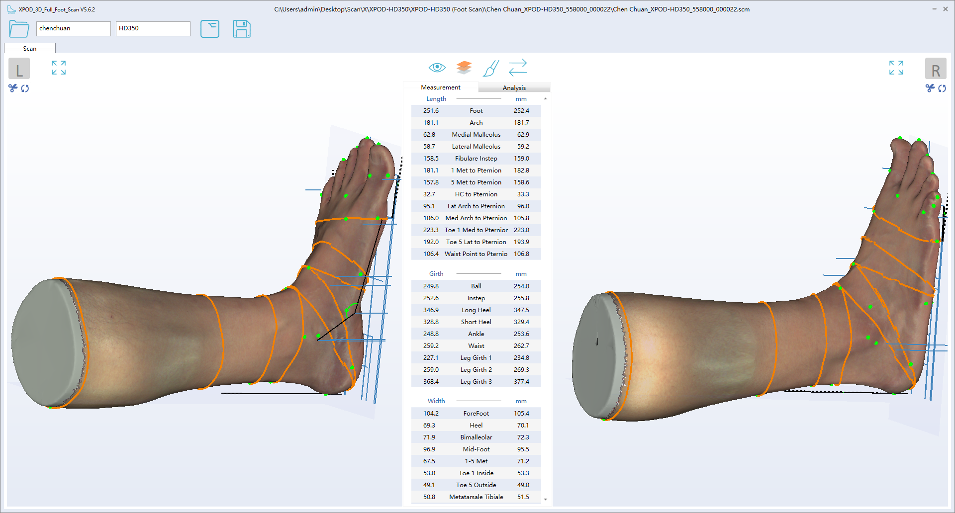 XPOD-HD350 Full Foot Scanner UI