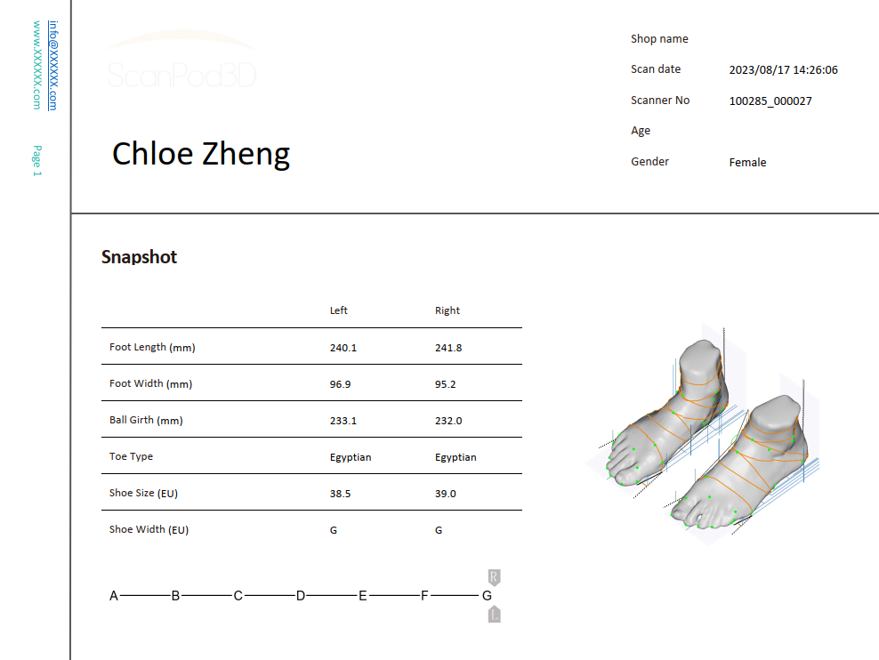 XPOD Full Foot Scanner Report