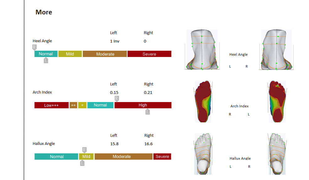 XPOD-SS2 Full Foot Scanner Report