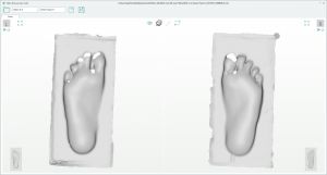 XSOL DUO Foot Plantar Scanner Files