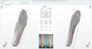 XSOL DUO Foot Plantar Scanner UI