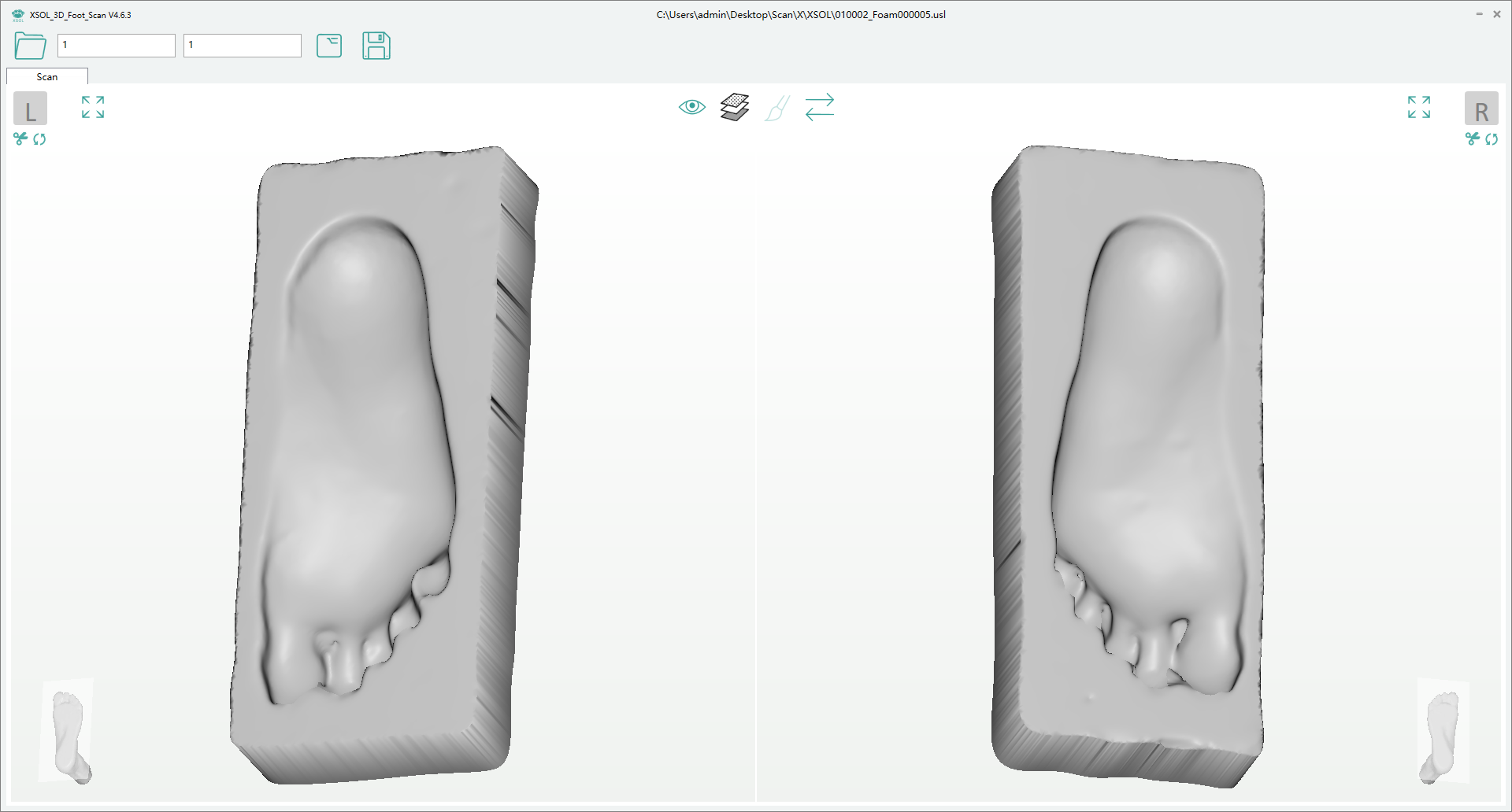 XSOL Foot Plantar Scanner Files